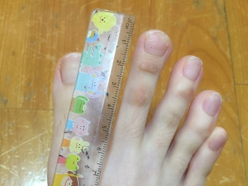 Tướng bàn chân hiếm báo trước chủ nhân là "con cưng" của thần Tài, cả đời không sợ thiếu tiền