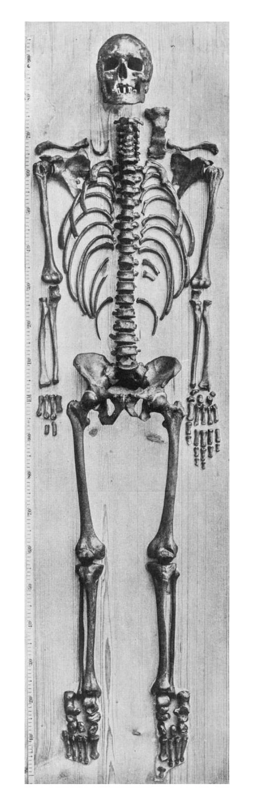 Bộ xương được cho là của thiên tài âm nhạc Bach. Ảnh chụp năm 1895 bởi Wilhelm His. Andreas Otte kiểm định bàn tay trái do xương bàn tay phải bị thiếu.