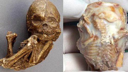 Kinh hãi người phụ nữ “đẻ” ra xác chết khô