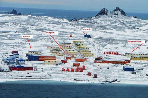 Kỳ lạ: Thị trấn muốn định cư phải cắt bỏ ruột thừa