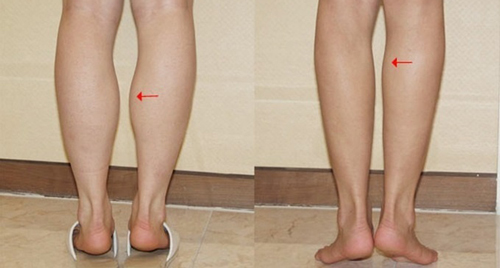 4 nét tướng tuy xấu nhưng có thể giúp tiền ập vào nhà, may mắn an nhàn bám riết chủ nhân không buông