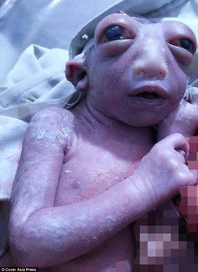 Hình ảnh em bé được cho là "người ngoài hành tinh" được sinh ra tại Ấn Độ.