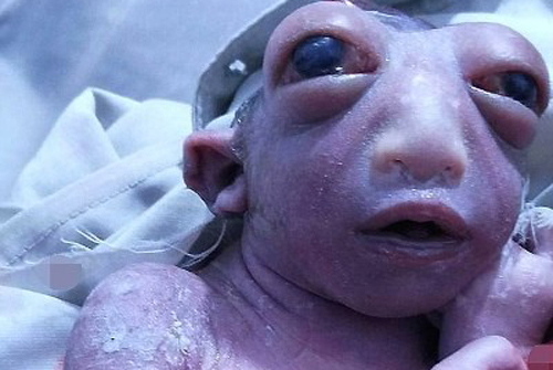 Hoảng hồn 'em bé ngoài hành tinh' sinh ra tại Ấn Độ