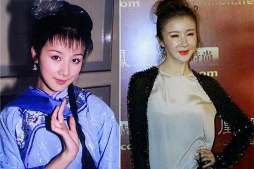 Những tượng đài nhan sắc bị hủy hoại bởi phẫu thuật thẩm mỹ