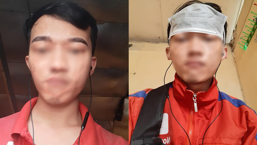 Nghe lời bạn đi xăm chân mày, vừa soi gương thanh niên đã "mất ăn mất ngủ" rồi lên mạng cầu cứu