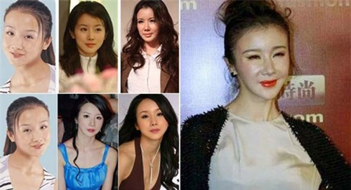 Mặt biến dạng vì lạm dụng dao kéo, sao nữ Hoa ngữ khiến fan nuối tiếc vẻ đẹp trong sáng ngày xưa