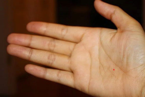 Ai có nốt ruồi son ở những vị trí này thì có thể chỉ ngồi ung dung đã được hưởng sung sướng suốt cuộc đời