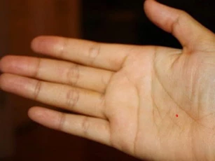 Ai có nốt ruồi son ở những vị trí này thì có thể chỉ ngồi ung dung đã được hưởng sung sướng suốt cuộc đời