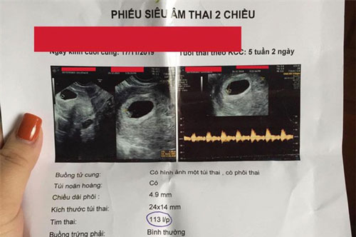 Bức xúc tố vợ cũ của chồng phá hoại hạnh phúc gia đình, cô gái nhận được ý kiến gây sốc thế này