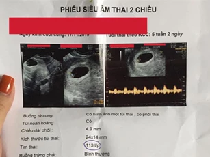Bức xúc tố vợ cũ của chồng phá hoại hạnh phúc gia đình, cô gái nhận được ý kiến gây sốc thế này
