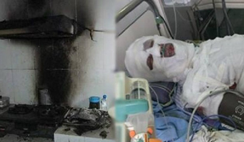 5 dấu hiệu cảnh báo bếp gas có thể nổ tung, mau chóng gọi thợ sửa ngay kẻo cả nhà gặp hoạ