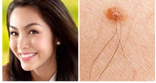 Những dấu hiệu bất ngờ trên cơ thể thông báo bạn sắp phát tài, có thể thăng quan tiến chức nhanh chóng đổi đời