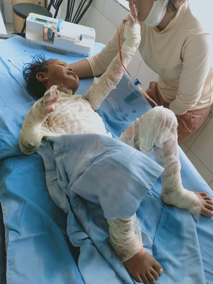 Vụ bé gái Cil Pam Mỹ Dung bị bỏng nặng: Giả Fanpage của nhà báo Lại Văn Sâm để kêu gọi ủng hộ