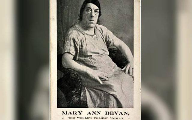 Những người phụ nữ kỳ lạ nhất: Từ khuôn mặt đàn ông đến "người vượn" đi diễn xiếc