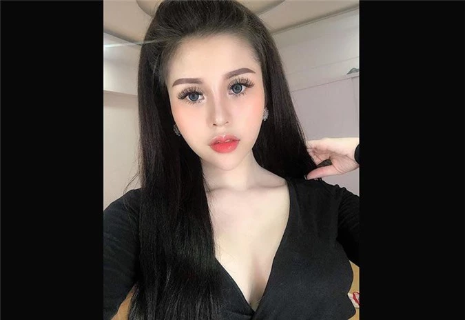 3 hotgirl MXH chi tiền tỉ &#34;đập mặt xây lại&#34;, sinh con ra càng lớn càng đẹp lạ kì - 11