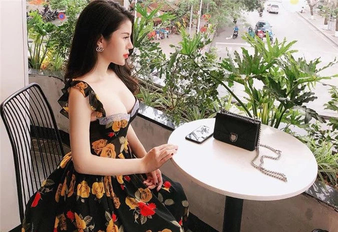 3 hotgirl MXH chi tiền tỉ &#34;đập mặt xây lại&#34;, sinh con ra càng lớn càng đẹp lạ kì - 16