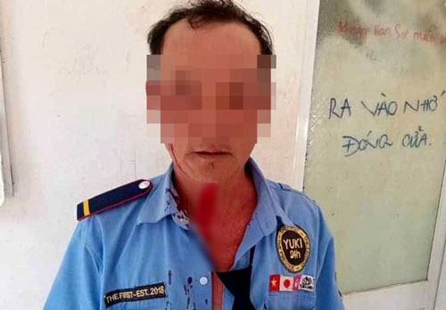 TPHCM: Nhắc nam thanh niên đeo khẩu trang, người bảo vệ bị đánh bầm mặt