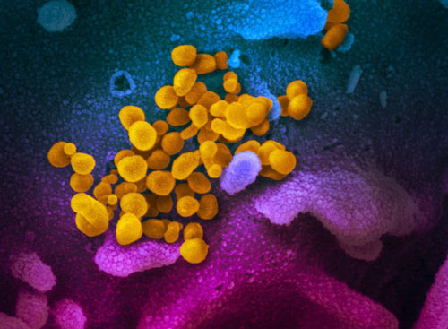 Phát hiện mới về virus SARS-CoV-2 giúp tìm ra điểm mấu chốt để điều chế vaccine