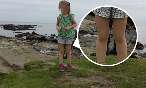 Tiết lộ "sốc" từ cha bé gái trong bức ảnh xuất hiện “đôi chân ma”