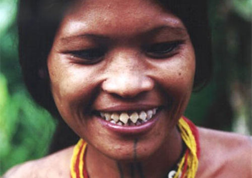 Mài răng thành hàm cá mập để trông quyến rũ hơn