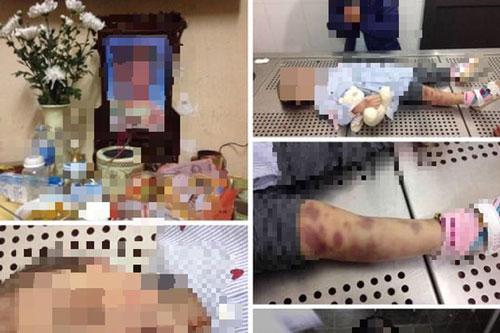 Hà Nội: Bé gái 3 tuổi nghi bị mẹ và cha dượng bạo hành đến tử vong