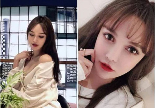 Bé gái phẫu thuật mặt khi 14 tuổi, "đập đi xây lại" 300 lần, tiêu tốn 12 tỷ đồng