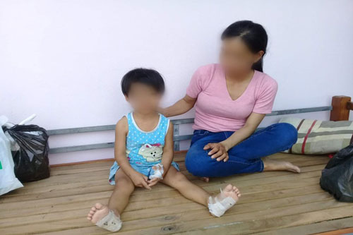 Nghi án bé gái bị cha dượng đánh đập, dí người vào ống pô nóng