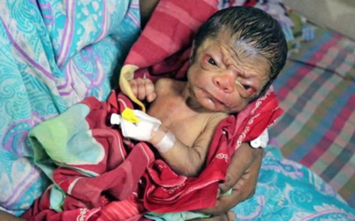 Em bé chào đời trong hình hài một ông lão khiến cả bác sĩ sững sờ và phản ứng bất ngờ của người mẹ