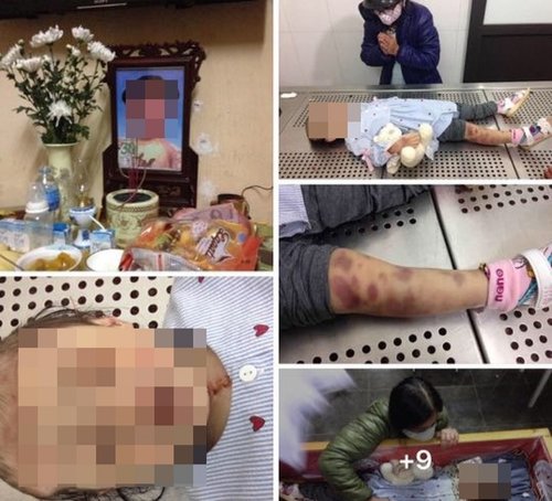 Khởi tố vụ án bé 3 tuổi bị bạo hành đến tử vong