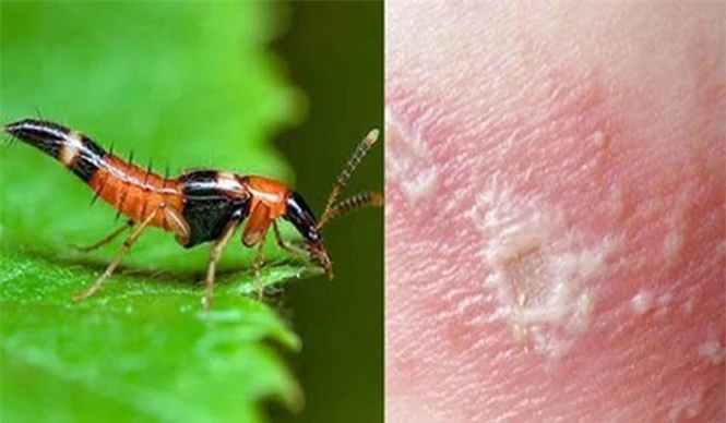 1001 thắc mắc: Loài kiến nào có nọc độc gấp 12 lần nọc rắn hổ mang? - ảnh 1