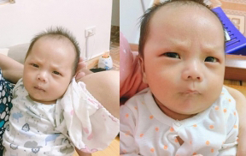 Bé trai sinh ra đã có khuôn mặt "cau có khó ở", biết được nguyên nhân ông bố cũng phải "giật mình"