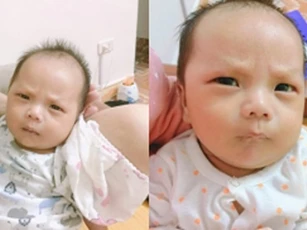 Bé trai sinh ra đã có khuôn mặt "cau có khó ở", biết được nguyên nhân ông bố cũng phải "giật mình"