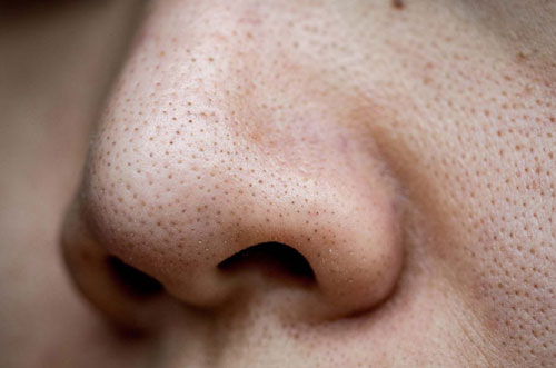 Chỉ cần chăm đắp mặt nạ rẻ tiền này, bao nhiêu mụn cám, mụn đầu đen đều biến mất mà da lại se khít lỗ chân lông