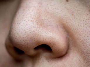 Chỉ cần chăm đắp mặt nạ rẻ tiền này, bao nhiêu mụn cám, mụn đầu đen đều biến mất mà da lại se khít lỗ chân lông