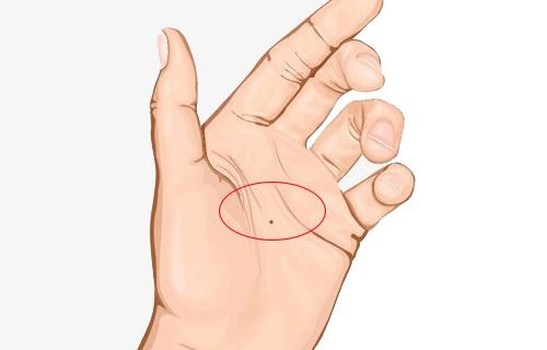 5 nốt ruồi "cực phẩm" của phụ nữ, ai may mắn sở hữu thì cuộc đời có thể giàu sang phú quý