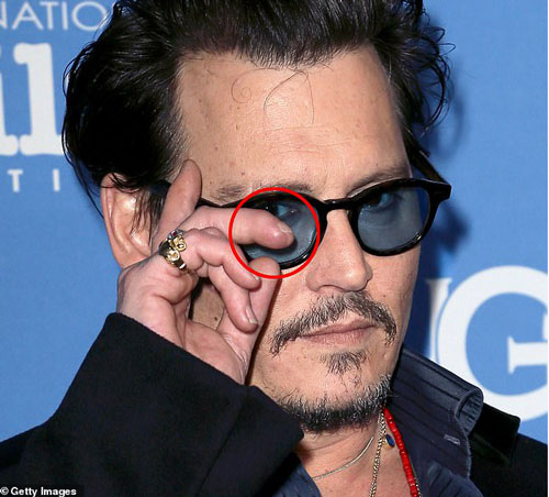 Tiết lộ sự thật về ngón tay bị chém gần đứt của Johnny Depp 5 năm trước