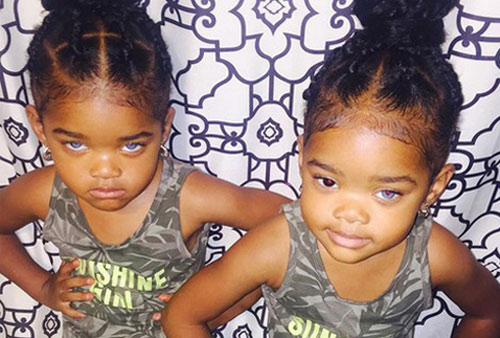 Giải mã nguyên nhân khiến một số người có hai màu mắt khác nhau?