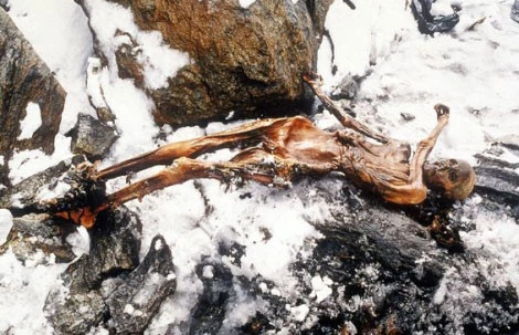 Người băng Ötzi