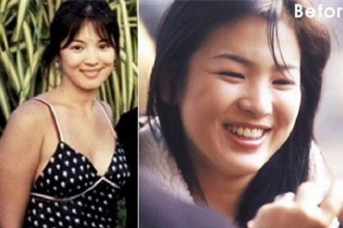 Trước khi trở thành mỹ nhân đẹp nhất xứ Hàn, Song Hye Kyo cũng có lúc mập đến mức này