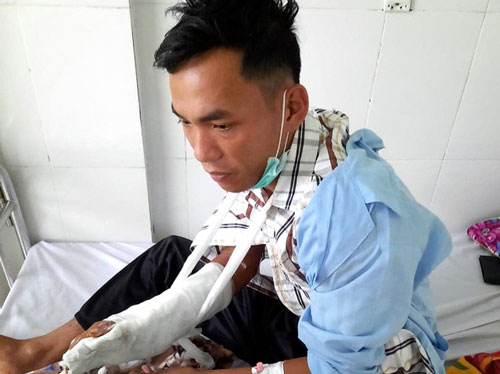 Kon Tum: Liên tiếp nhiều vụ nhân viên bảo vệ rừng bị đánh trọng thương