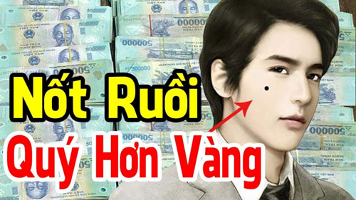 Nốt ruồi “ngàn vàng khó mua”, ai sở hữu có thể  giàu sang 1 đời