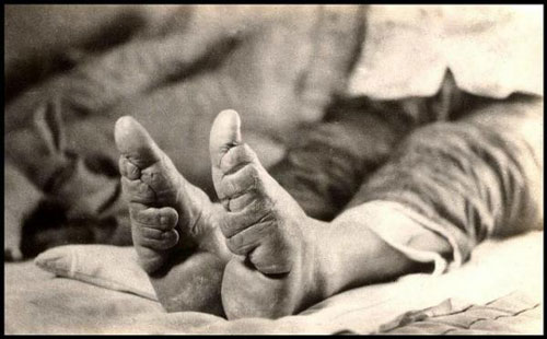 CLIP: Tục bó chân 'gót sen' và nước mắt của thiếu nữ Trung Quốc