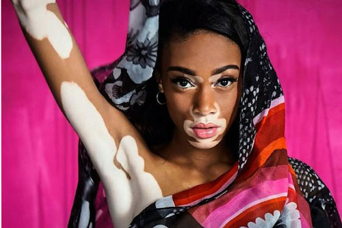 Những cô nàng có vẻ đẹp “độc và lạ” nhất hành tinh