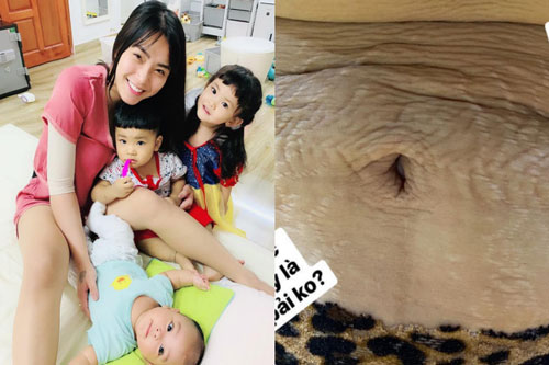 "Mẹ 3 con" Hải Băng chia sẻ hình ảnh cận cảnh vòng 2 đầy vết rạn da chằng chịt, nhiều bà mẹ đều thấy đồng cảm