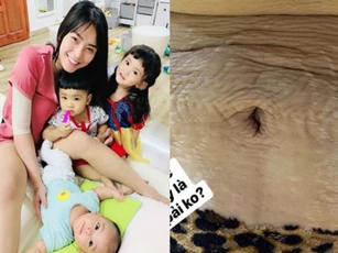 "Mẹ 3 con" Hải Băng chia sẻ hình ảnh cận cảnh vòng 2 đầy vết rạn da chằng chịt, nhiều bà mẹ đều thấy đồng cảm