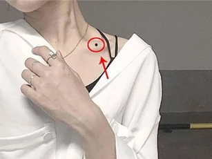 Vị trí nốt ruồi "phản chủ" kéo hết vận xui về người, xóa ngay nếu không muốn bị phá lộc phá duyên