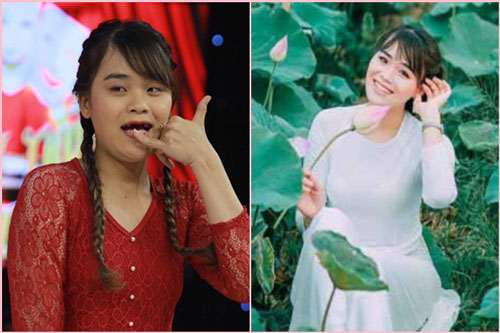 Ngỡ ngàng với ca "lột xác vi diệu" của cô nàng "Thánh sún" từng thắng giải 100 triệu đồng