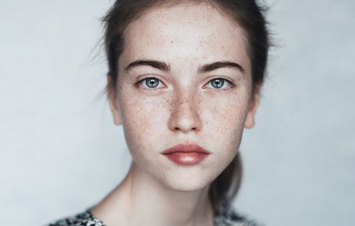 4 thực phẩm "đại kỵ" với da nám, tàn nhang: Càng ăn càng bị nặng