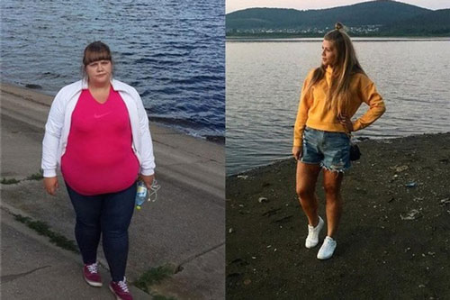 Đây là 10 ca lột xác ngoạn mục nhờ giảm cân: Người giảm nhiều nhất đến 200kg