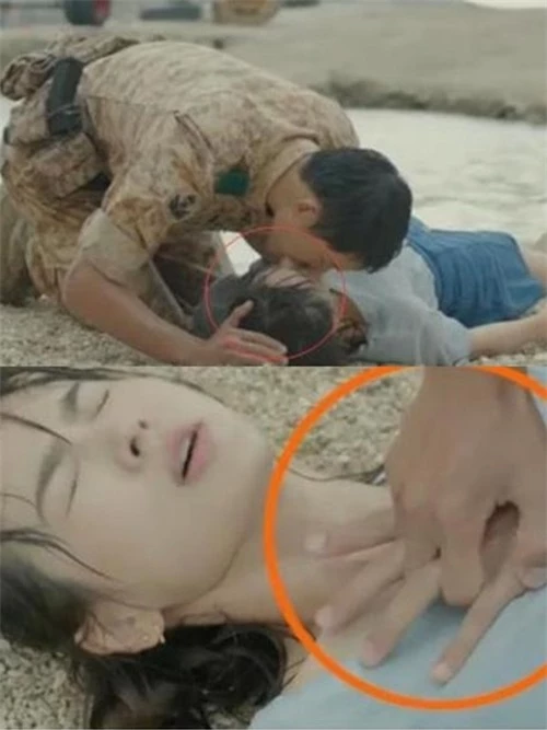 Khi Mo Yeon bị đuối nước, Yoo Si Jin đã làm hô hấp nhân tạo không chính xác. Lúc thổi hơi vào miệng cô, tay anh không bịt mũi của cô. Còn lúc ép tim ngoài lồng ngực, anh đặt tay quá cao, gần lên đến cổ thay vì ở vị trí của tim.